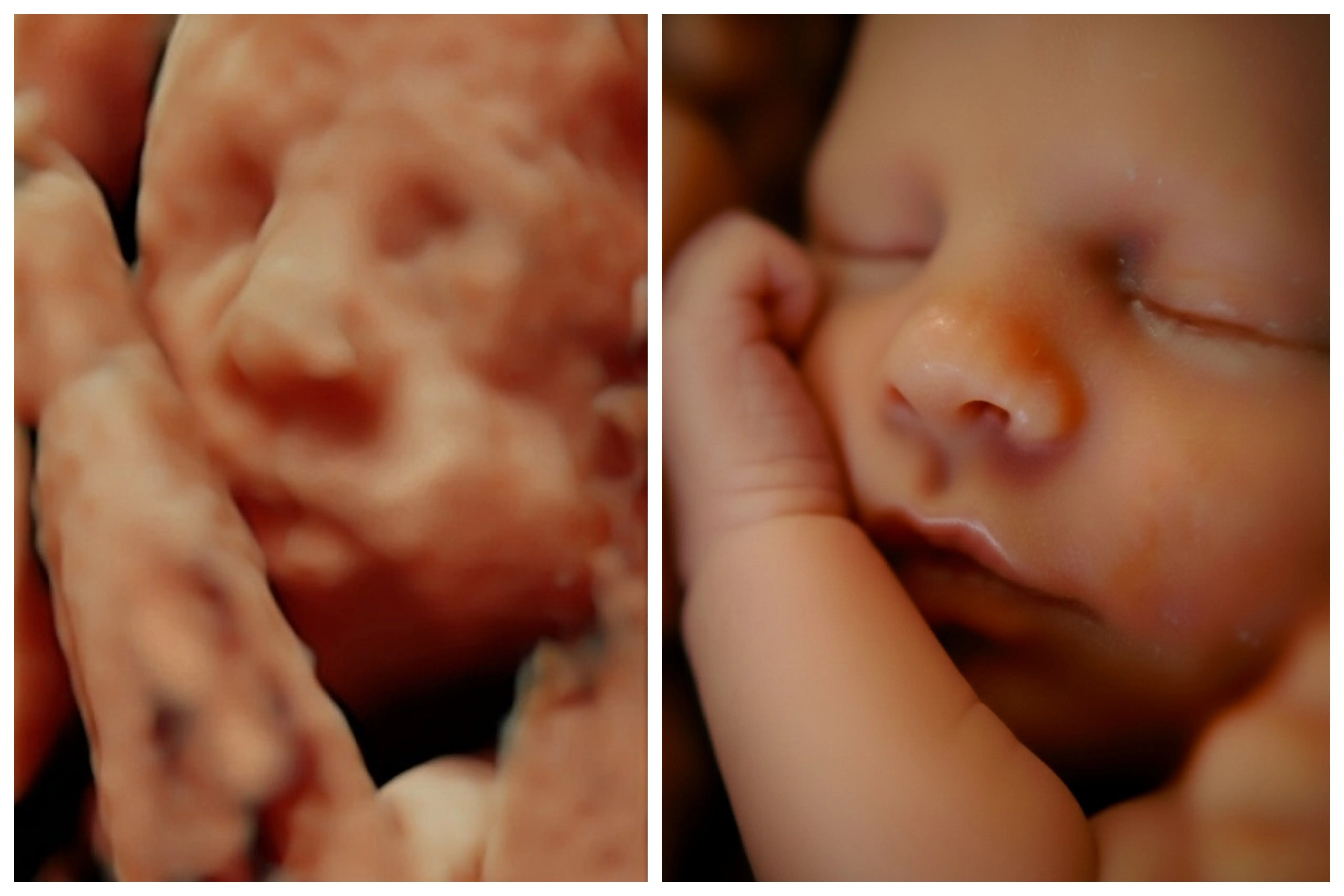 Ecografía 8K HD procesada con IA - Econatal Galicia Baleares