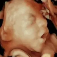 Detalle mano bebé en ecografía 5D - Econatal