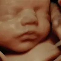 Bebé sonriendo en ecografía 5D emocional - Econatal